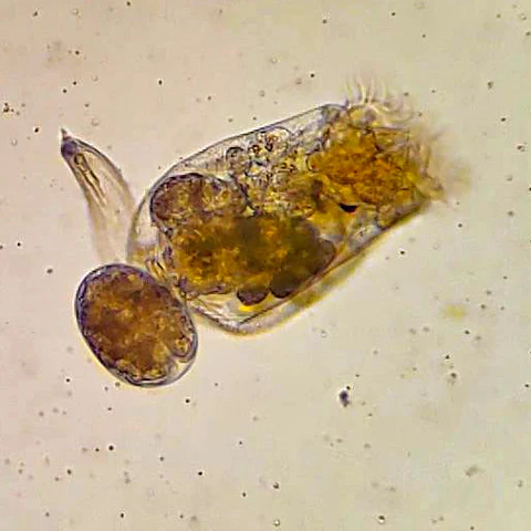 Rotifer under Microscope 
